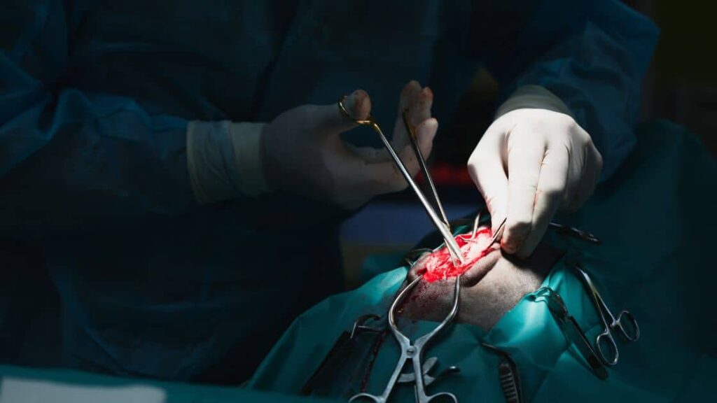 A spinal cord surgery being conducted: medical malpractice happens often.