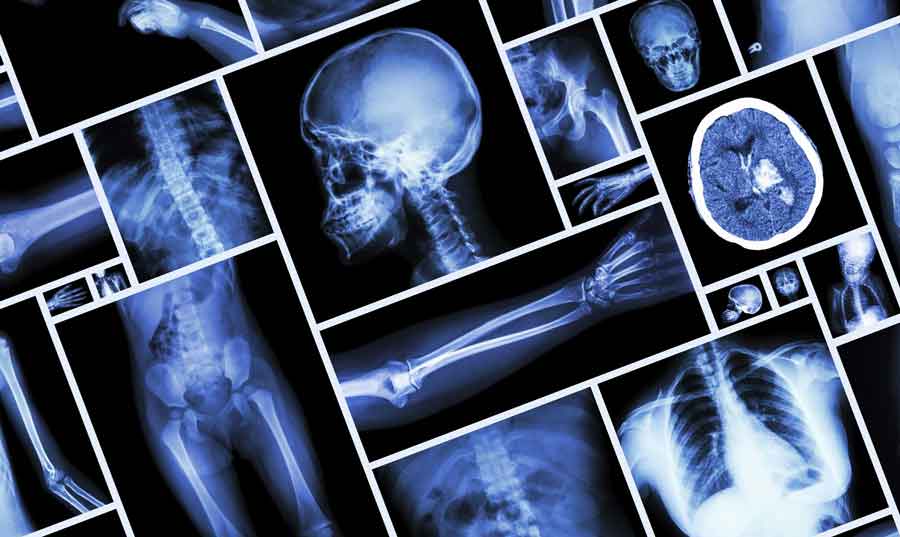 Orthopaedic Injury Law firm