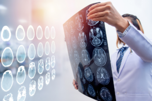 Brain Injuries_ The Invisible Injury